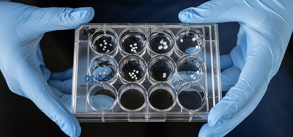 30- and 60-day-old brain organoids in a Petri dish 30- and 60-day-old brain organoids in a Petri dish